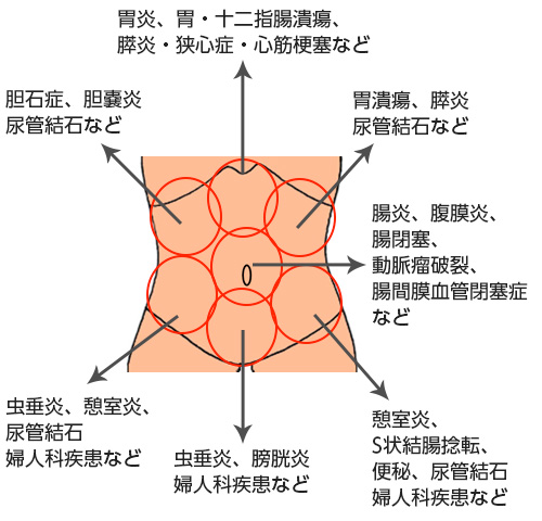 腹痛について 大阪市立十三市民病院