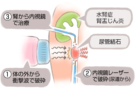 Q A 大阪市立十三市民病院