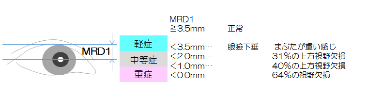 眼瞼下垂の程度