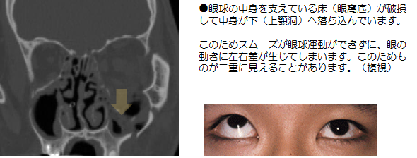 顔面骨骨折 形成外科 完全予約制 公式 大阪市立総合医療センター