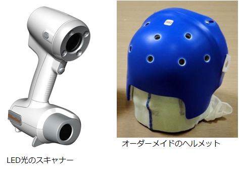 ヘルメットによる頭蓋形状誘導療法