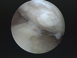 膝関節の治療