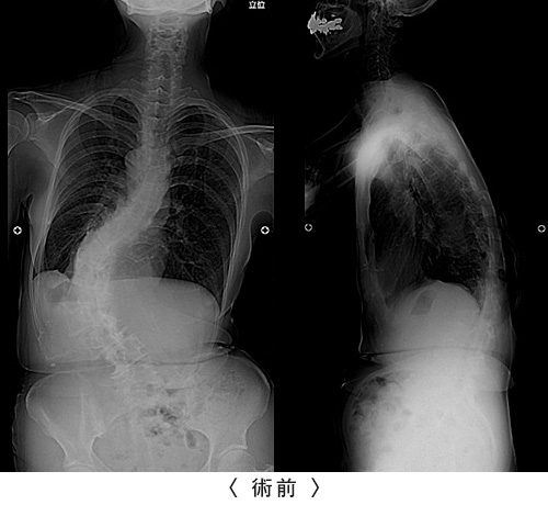 脊椎外科 整形外科 完全予約制 大阪市立総合医療センター