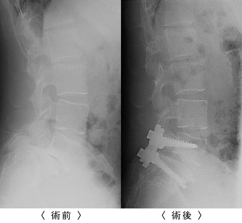 術前／術後