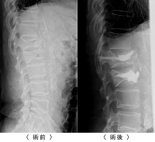 術前／術後