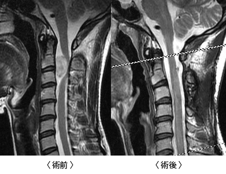 術前／術後