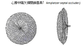 心房中隔欠損閉鎖器具