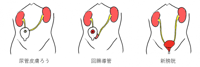手術支援ロボット「ダヴィンチ」について | 泌尿器科 | 【公式】 大阪市立総合医療センター