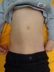 （図３）