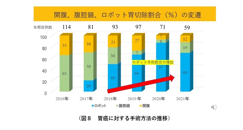 図８　胃がん手術