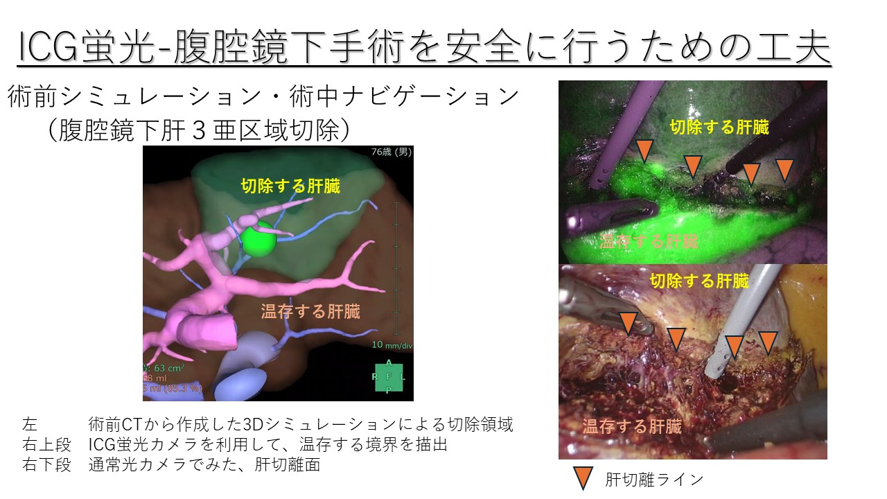 消化器外科 | 【公式】 大阪市立総合医療センター